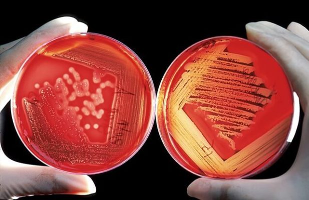 Entenda A Função Do Ágar Bacteriológico E Como é Usado | Prolab